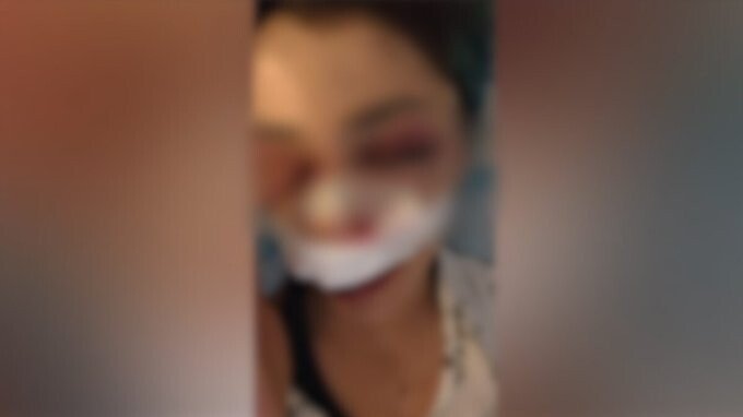 Identificati i due aggressori della studentessa picchiata a Bari nel parco