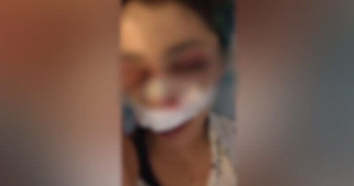 Picchiata da un branco nel parco di Bari, indagati l’addetta ai bagni e il compagno